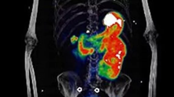 jnm_may_2024_hofman.jpg PET Scan