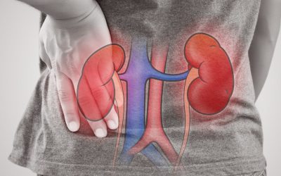 NICE launched its consultation on new draft kidney cancer clinical guideline