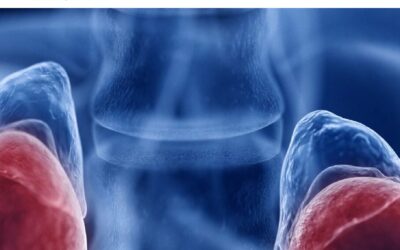 National Kidney Cancer Audit report pinpoints areas for improvement in England